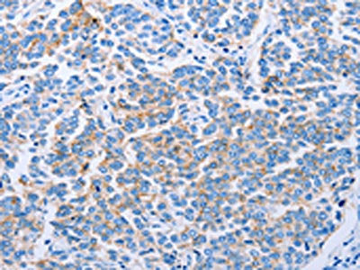 CLDN4 Antibody