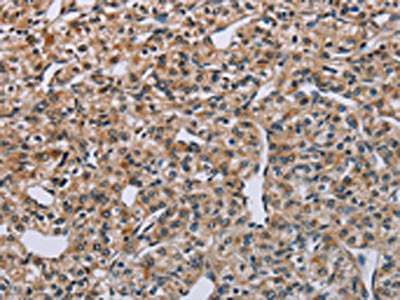 PNPT1 Antibody