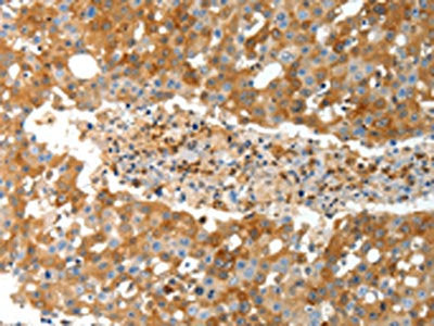 TEP1 Antibody