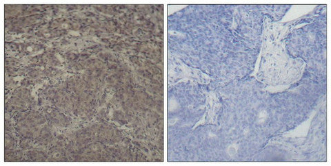 Phospho-CREB1 (Ser142) Antibody