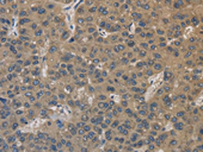 EMC8 Antibody