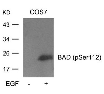 Phospho-Bad (Ser112) Antibody