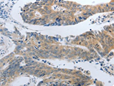 SLC5A5 Antibody