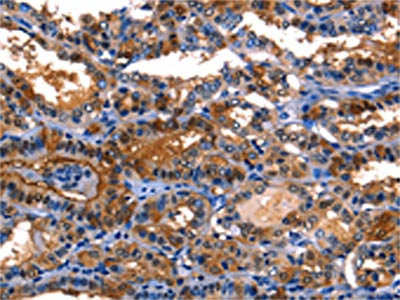 LGALS8 Antibody