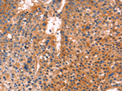ANTXR1 Antibody