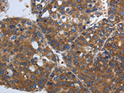 SOCS1 Antibody