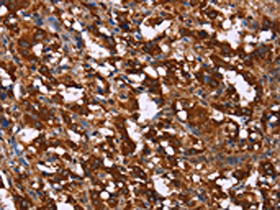 GAGE12I Antibody
