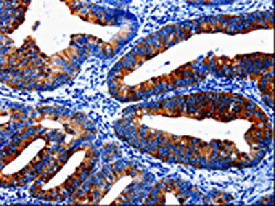 EPHX1 Antibody
