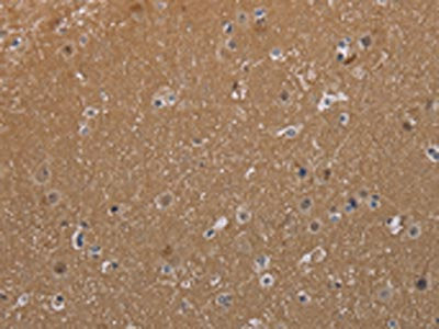 MAGEL2 Antibody