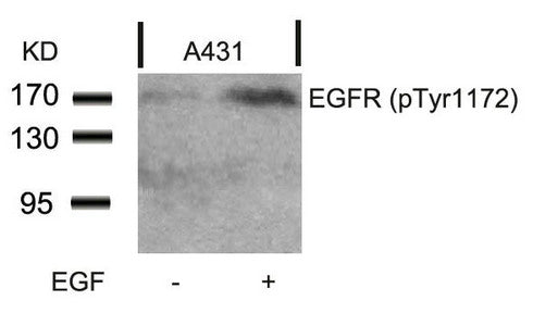 Phospho-EGFR (Tyr1172) Antibody