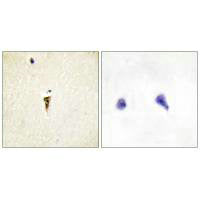 ICK Antibody