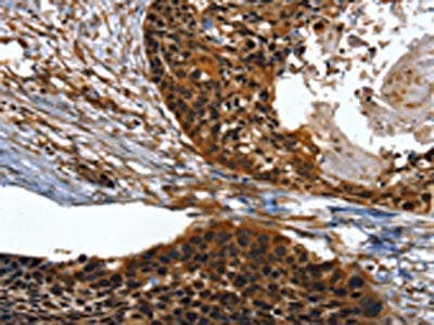 TWF1 Antibody