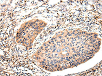 IGLV1-51 Antibody