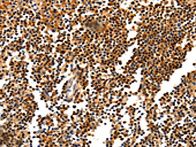 HDAC1 Antibody