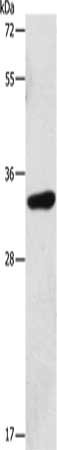 MAGEA3 Antibody