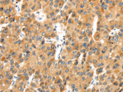 MACC1 Antibody