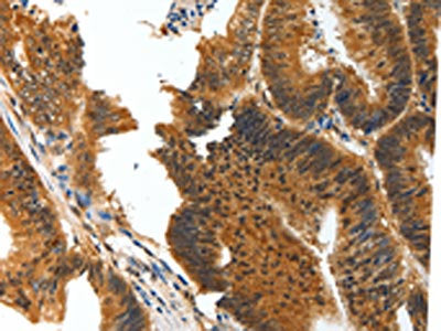 BIRC6 Antibody