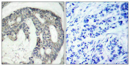 Phospho-NOS3 (Ser1177) Antibody