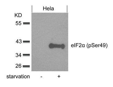 Phospho-EIF2S1 (Ser49) Antibody