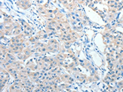 AKAP9 Antibody