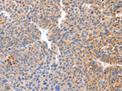 B3GAT1 Antibody