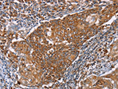 PMPCB Antibody