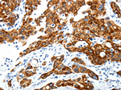 ABI3BP Antibody