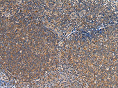 FST Antibody