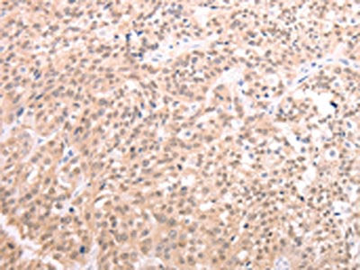 TXN Antibody