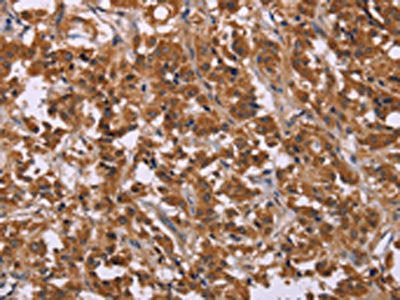 CMTM6 Antibody