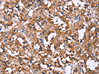 SLC52A1 Antibody