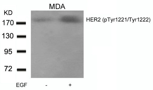 Phospho-ERBB2 (Tyr1221/Tyr1222) Antibody