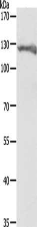 PC Antibody