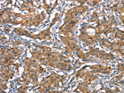 CDC25A Antibody