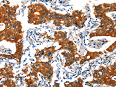 HTR3B Antibody