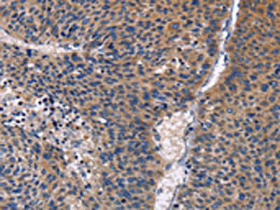 PRKCD Antibody