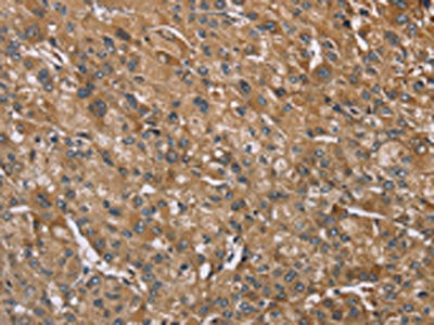 IQCJ Antibody