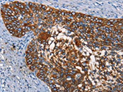 CD68 Antibody