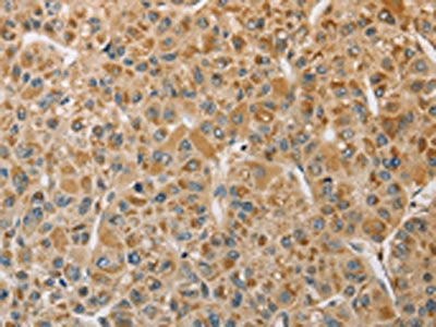 MIP Antibody
