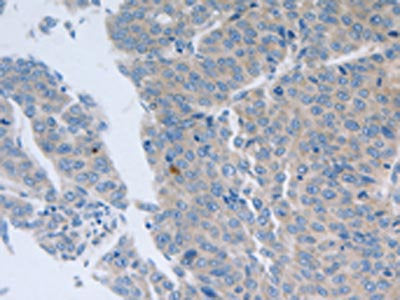 GRIN1 Antibody