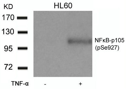 Phospho-NFKB1 (Ser927) Antibody