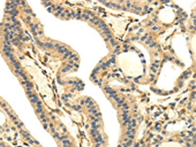 UHRF1BP1 Antibody