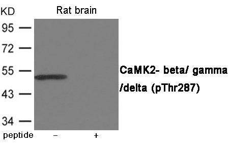 Phospho-CAMK2B/CAMK2G/CAMK2D (Thr287) Antibody