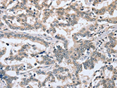 PTGER1 Antibody