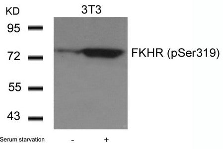 Phospho-FOXO1 (Ser319) Antibody