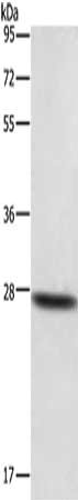 DKK2 Antibody