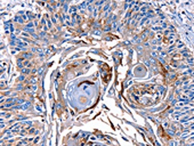 LRP2 Antibody