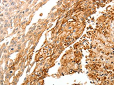 TGM1 Antibody