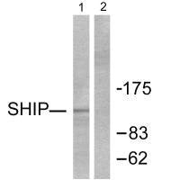 INPP5D Antibody
