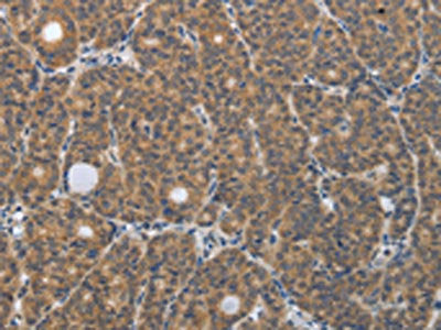 PGR Antibody